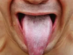 Frasi sul linguaggio